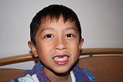Loses more teeth