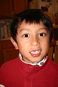 Malin loses the second tooth
